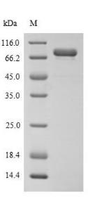 SDS-PAGE (MADCAM1-2538H).jpg